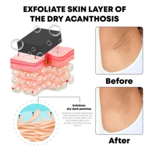 صابون سفید کننده و رفع تیرگی کانتودیا زغال چوب بامبو NIGRICANS‏ (کارتن سبز)