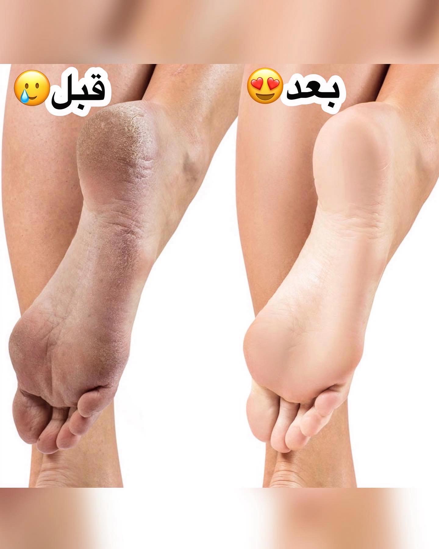 کرم ترک پا و دست برند تاپ لیدی کد T27006