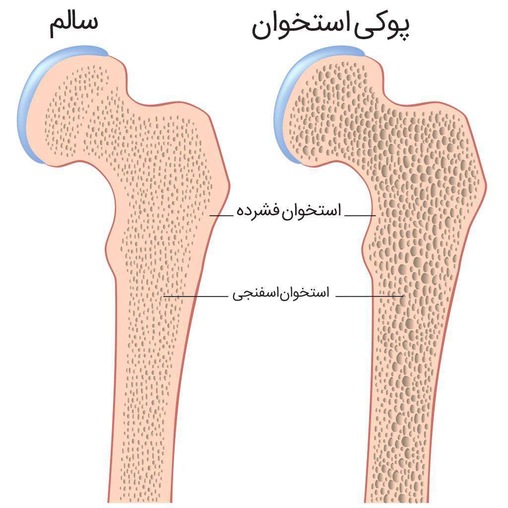 عوارض سیگار برای پوست و مو 2